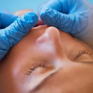 Buccal Sculpting Massage at Brazilia Skin Care